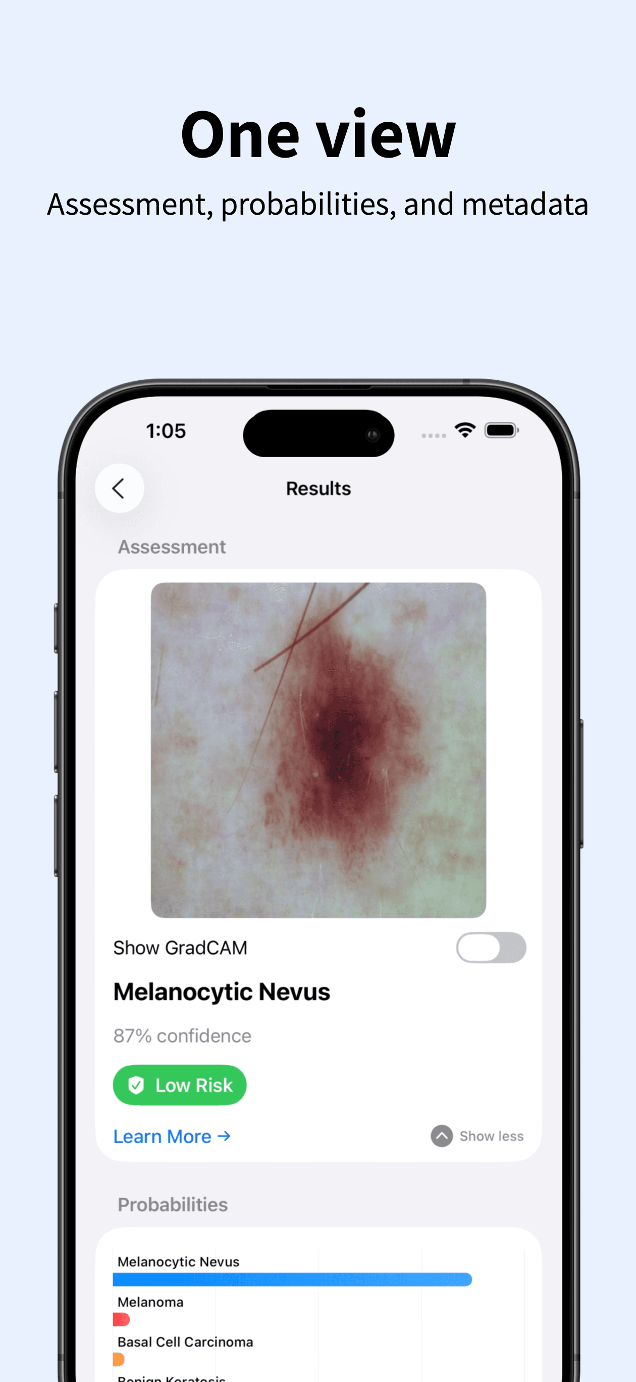 DermaFusion screen 5